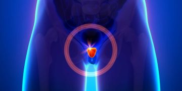 Πολυπαραμετρική Μαγνητική Τομογραφία Προστάτη: Mια Αντρική Υπόθεση