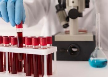 Νέα εξέταση αίματος για έγκαιρη ανίχνευση καρκίνου