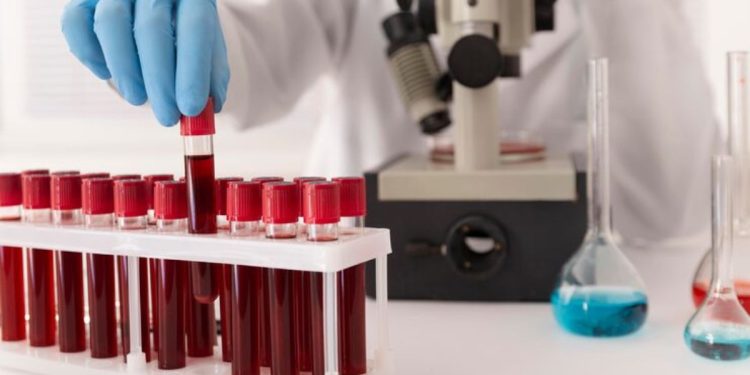 Νέα εξέταση αίματος για έγκαιρη ανίχνευση καρκίνου